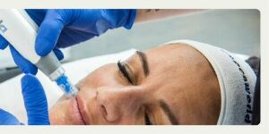 St-Laurent Médico-Esthétique Microneedling DP4 Treatment