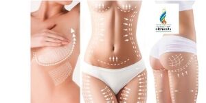 Zest Beauty Boutique Body Sculpting in Saskatoon