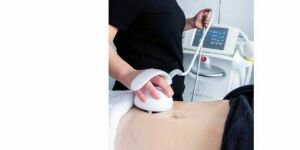 St-Laurent Médico-Esthétique Soin Venus Freeze - Abdomen ou visage complet