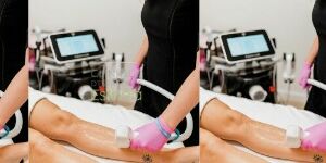 Clinique Esthéa Chèque-cadeau électronique pour une épilation au laser Triton